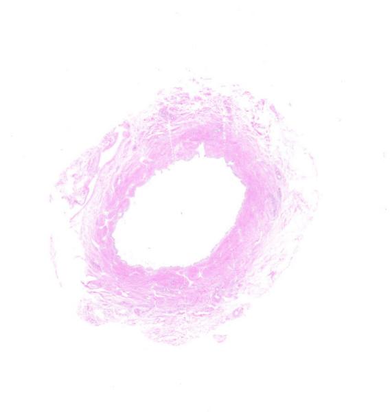 Object Preview