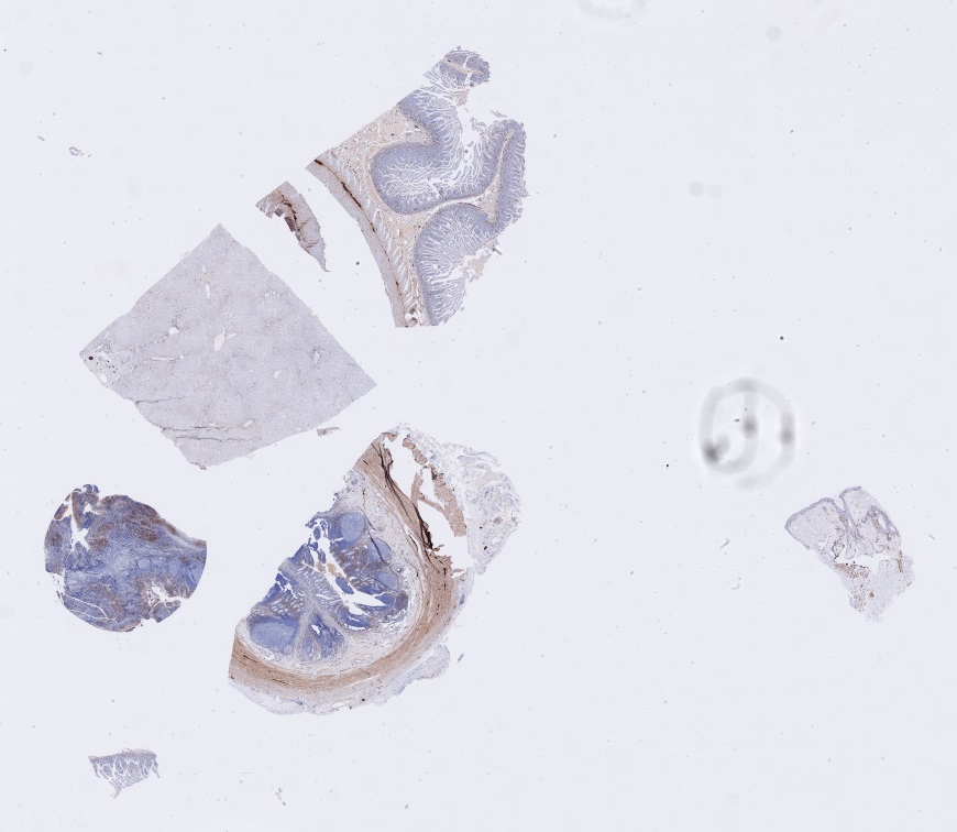 Object Preview