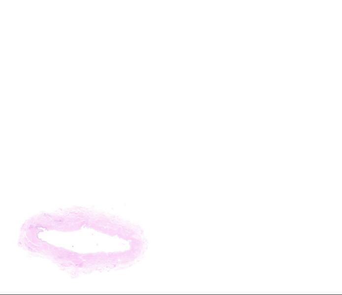 Object Preview