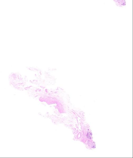 Object Preview